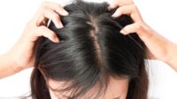 Ilustrasi. Faktanya bahwa kehadiran kutu di rambut lebih dipengaruhi oleh kebiasaan sehari-hari yang tanpa disadari [foto:dok/alodoc]